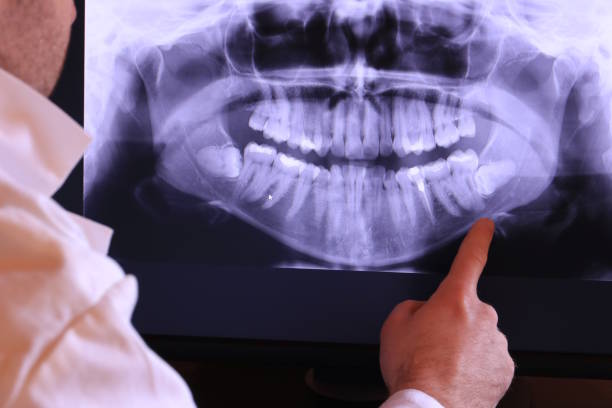 Best Emergency Treatment for Oral Infections in Twentynine Palms, CA
