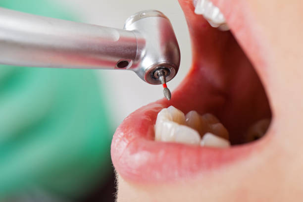 Best Emergency Orthodontic Repairs in Twentynine Palms, CA